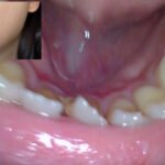 【素人】【特価】口腔観察VOL.2 4名55分お買い得セット│口内クイーン│h_1651nko00005