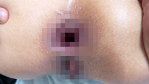 【素人】ケツ穴確定フルコース超デカマラをブチ込みまくります【自己肯定感低い超内気レイヤーは何でもOKなのでエロ漫画以上のハードコア飼育試してみました】アナル＆マ●コ2穴同時挿入6P大乱交│二代目つば飲みおじさん（全日本カメコ協同組合/妄想族）│scdc00004