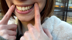 【素人】【特価】口腔観察VOL.3 4名59分お買い得セット│口内クイーン│h_1651nko00003