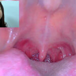 【素人】街角で声をかけて口内観察させてもらう アパレル関係 ひなみちゃん│口内クイーン│h_1651nko0500003