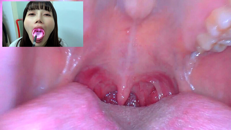 【素人】街角で声をかけて口内観察させてもらう アパレル関係 ひなみちゃん│口内クイーン│h_1651nko0500003