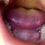 【素人】街角で声をかけて口内観察させてもらう 商社営業 れなちゃん│口内クイーン│h_1651nko0600005