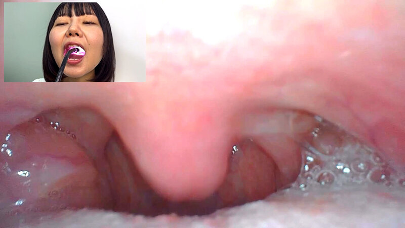 【素人】街角で声をかけて口内観察させてもらう テレビ局AD みゆりちゃん│口内クイーン│h_1651nko0600006