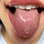 【素人】街角で声をかけて口内観察させてもらう モデル まいなちゃん│口内クイーン│h_1651nko0600007