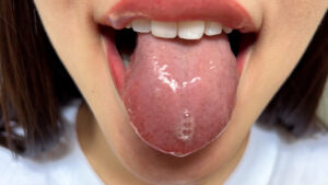 【素人】街角で声をかけて口内観察させてもらう モデル まいなちゃん│口内クイーン│h_1651nko0600007