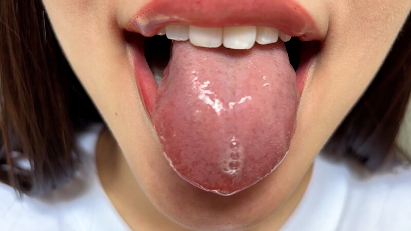 【素人】街角で声をかけて口内観察させてもらう モデル まいなちゃん│口内クイーン│h_1651nko0600007