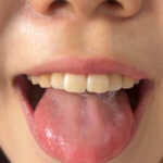 【素人】街角で声をかけて口内観察させてもらう アパレル店員 さゆりちゃん│口内クイーン│h_1651nko400003