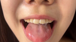 【素人】街角で声をかけて口内観察させてもらう アパレル店員 さゆりちゃん│口内クイーン│h_1651nko400003