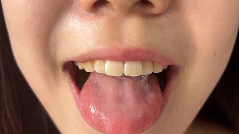 【素人】街角で声をかけて口内観察させてもらう アパレル店員 さゆりちゃん│口内クイーン│h_1651nko400003