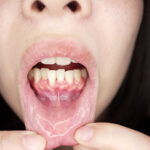 【素人】【個人撮影】湊波流の変態男の歯＆ベロ 臭いチェック！│やっちまん│h_1651y00327