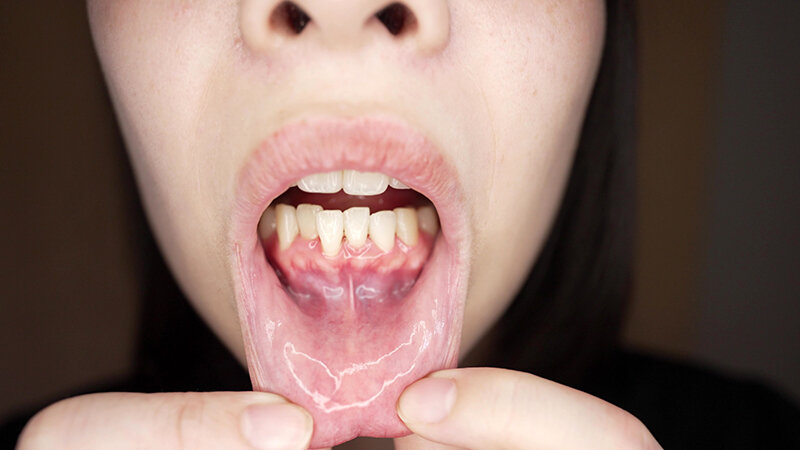 【素人】【個人撮影】湊波流の変態男の歯＆ベロ 臭いチェック！│やっちまん│h_1651y00327