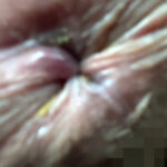 【素人】街角で声をかけてアナル観察させてもらう 大学生 ゆゆちゃん│尻美人│h_1651ana0300003