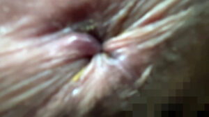 【素人】街角で声をかけてアナル観察させてもらう 大学生 ゆゆちゃん│尻美人│h_1651ana0300003