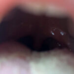 【素人】街角で声をかけて口内観察させてもらう 大学生 ゆゆちゃん│口内クイーン│h_1651nko00031