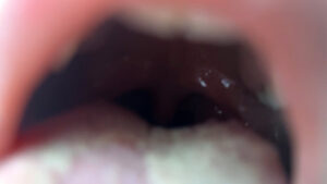 【素人】街角で声をかけて口内観察させてもらう 大学生 ゆゆちゃん│口内クイーン│h_1651nko00031