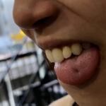 【素人】街角で声をかけて口内観察させてもらう オーガニックスーパー勤務 はつみちゃん│口内クイーン│h_1651nko0300003