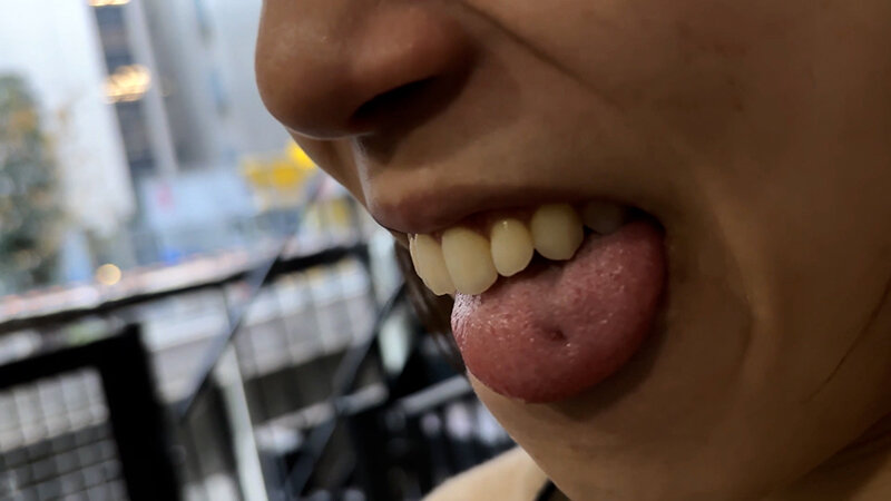 【素人】街角で声をかけて口内観察させてもらう オーガニックスーパー勤務 はつみちゃん│口内クイーン│h_1651nko0300003