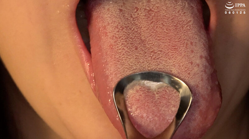 【素人】「素人モデルの超激レアな口内・歯・歯抜け・のどちんこ観察プレイ！」素人美女ナナ│アドア│h_1416ad01817