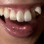 【素人】街角で声をかけて口内観察させてもらう 時計屋店員 みらいちゃん│口内クイーン│h_1651nko00023