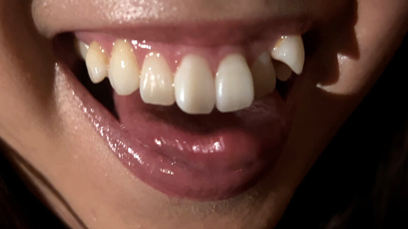 【素人】街角で声をかけて口内観察させてもらう 時計屋店員 みらいちゃん│口内クイーン│h_1651nko00023