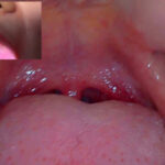 【素人】街角で声をかけて口内観察させてもらう 飲食店アルバイト みこちゃん│口内クイーン│h_1651nko0500004